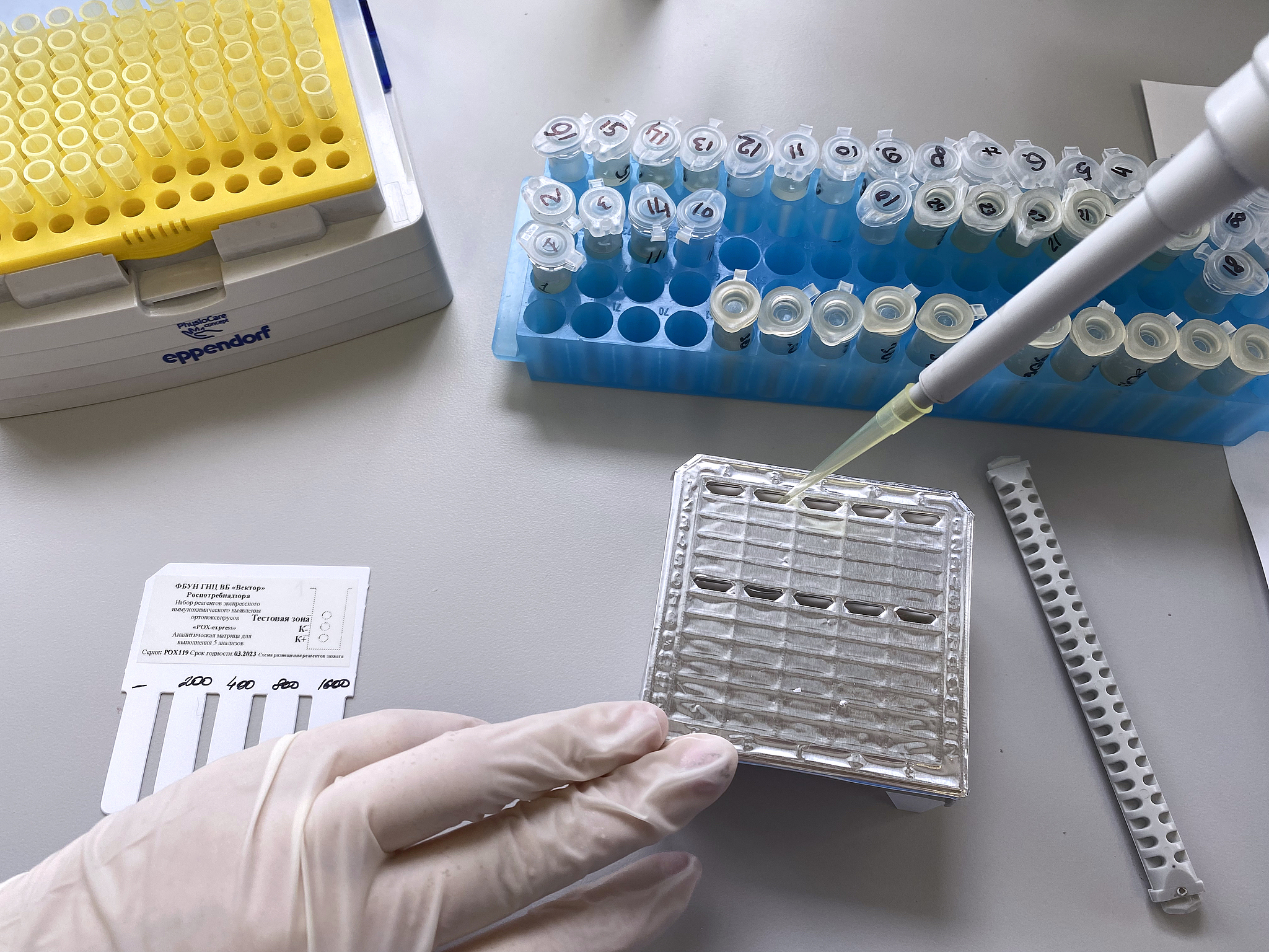 A monkeypox test kit at the State Research Center of Virology and Biotechnology Vector in Novosibirsk, Russia. /CFP