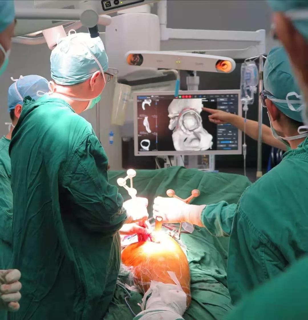 China completes robot-assisted total hip replacement surgery - Xinhua | English.news.cn