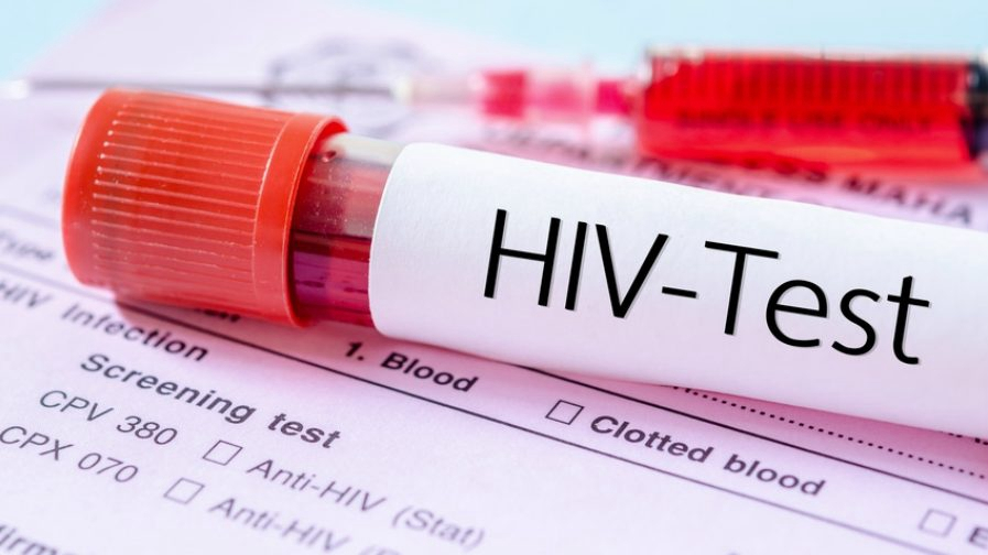 Quiz: The fight against HIV - CGTN