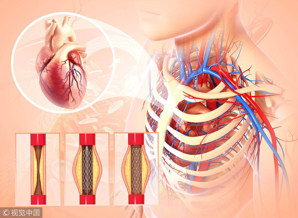 World Heart Day: How to take care of your heart properly? - CGTN