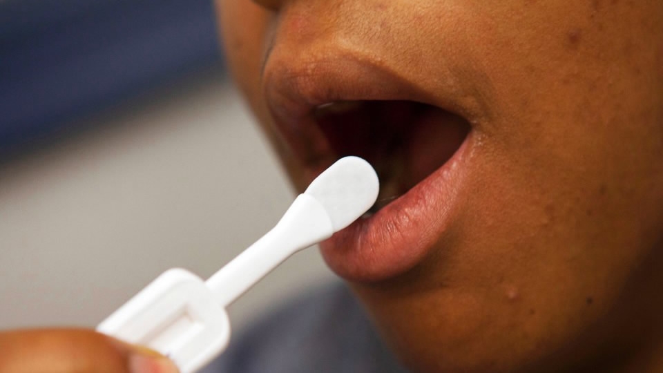 Uganda To Introduce Oral Hiv Self Test Kit Cgtn