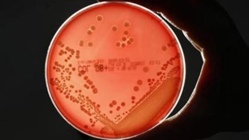 Scientists show which surfaces attract clingy Staph bacteria